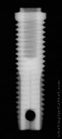 Radiograph of Stern EX