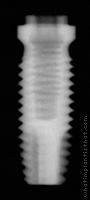Radiograph of Stern EX