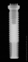 Radiograph of Stern EX