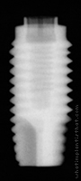 Radiograph of Stern EX