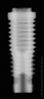 Radiograph of Stern EX