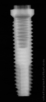 Radiograph of Stern EX