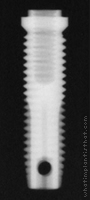 Radiograph of Stern EX