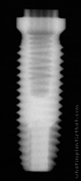 Radiograph of Stern EX