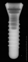 Radiograph of Stern IC