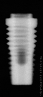 Radiograph of Stern EX