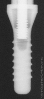 Radiograph of Standard Plus WN