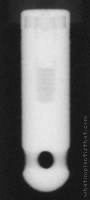 Radiograph of Calcitek Spline Reliance Cylinder