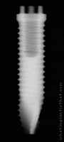 Radiograph of Calcitek Spline Twist
