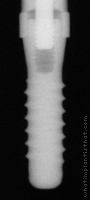 Radiograph of Standard Plus NN