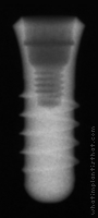 Radiograph of Standard Plus RN