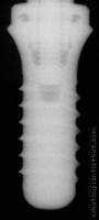 Radiograph of Standard Plus WN