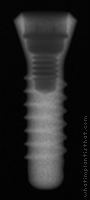 Radiograph of Standard RN