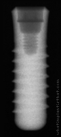 Radiograph of Standard RN
