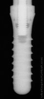 Radiograph of Standard RN