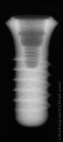Radiograph of Standard WN