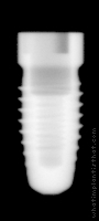 Radiograph of Steri-Oss Replace Select