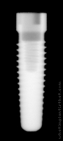 Radiograph of Steri-Oss Replace Select