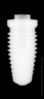 Radiograph of Steri-Oss Replace