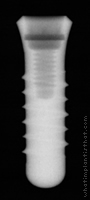 Radiograph of Stern IC