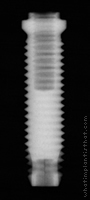 Radiograph of Swede-Vent