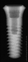 Radiograph of SwishPlant