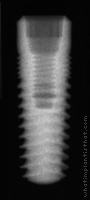 Radiograph of SwishPlant