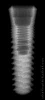 Radiograph of SwishPlant