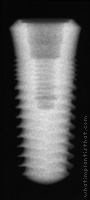 Radiograph of SwishPlant