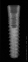 Radiograph of SwishPlant