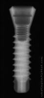 Radiograph of SybronPro TL