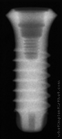 Radiograph of SybronPro TL