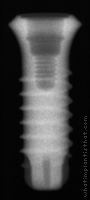 Radiograph of SybronPro TL