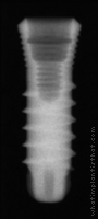 Radiograph of SybronPro XRT