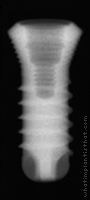 Radiograph of SybronPro XRT
