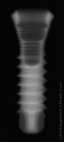 Radiograph of SybronPro XRT
