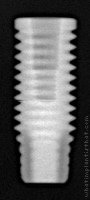 Radiograph of Titamax CM Cortical