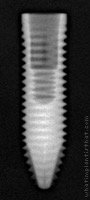 Radiograph of Titamax CM EX