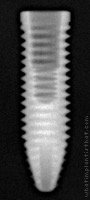 Radiograph of Titamax CM EX