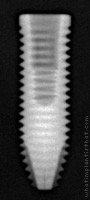 Radiograph of Titamax CM EX