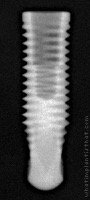 Radiograph of Titamax CM Medular