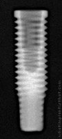 Radiograph of Titamax Cortical
