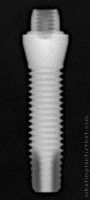Radiograph of Titamax G T Cortical