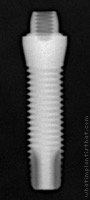 Radiograph of Titamax G T Cortical