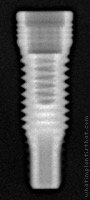 Radiograph of Titamax II Plus