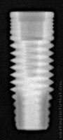 Radiograph of Titamax II Plus