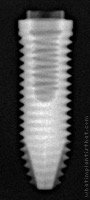 Radiograph of Titamax T I EX