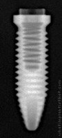 Radiograph of Titamax T I EX