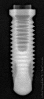 Radiograph of Titamax T I Medular