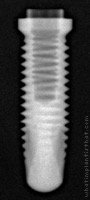 Radiograph of Titamax T I Medular